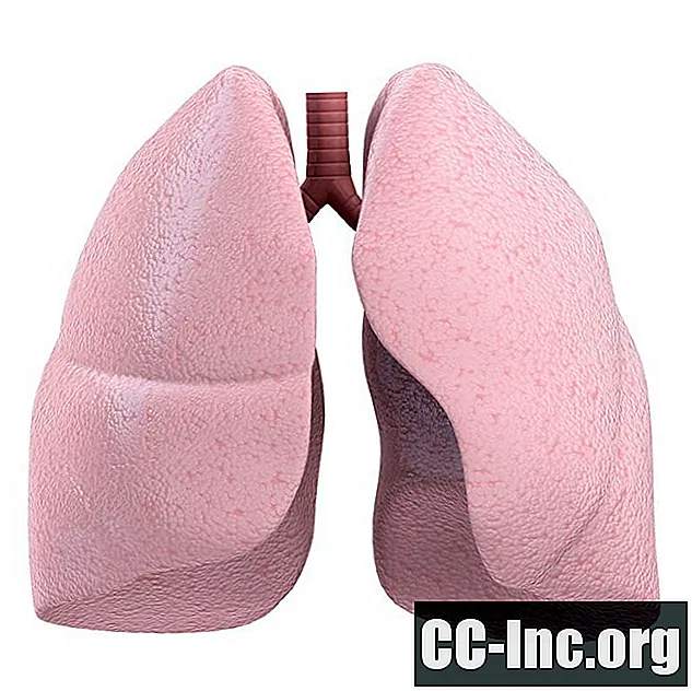 Hilum keuhkosta: anatomia ja poikkeavuudet