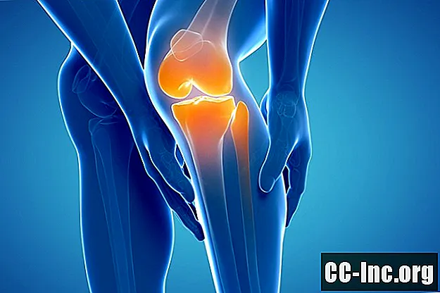 Douleur à la hanche et au genou dans la sclérose en plaques - Médicament