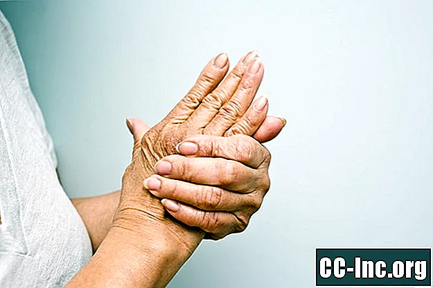 Hur artrodes (ledfusion) kan behandla avancerad artrit