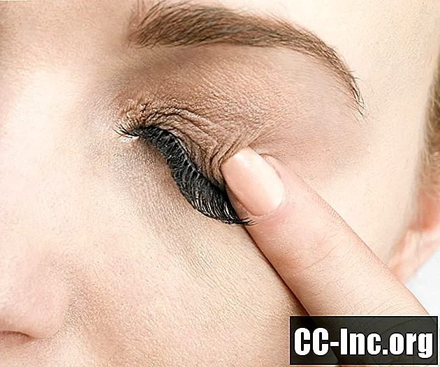Pregled naprezanja očiju (astenopija)