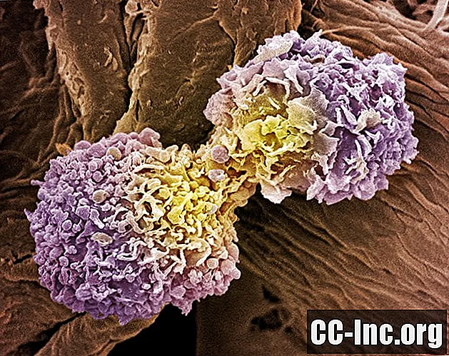כיצד סרטן השד מתפשט וחוזר על עצמו