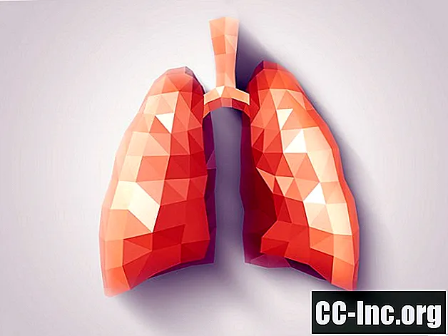 Kako se diagnosticira bronhiektazija