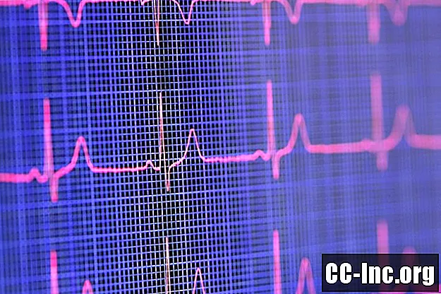 Kuinka COVID-19 voi vaikuttaa sydämeesi - Lääke