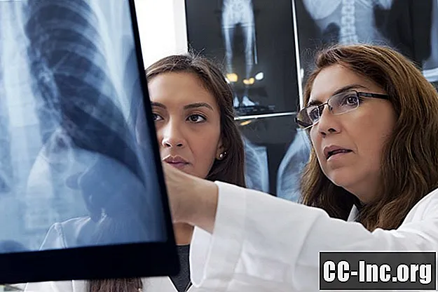 כיצד צילומי רנטגן בחזה יכולים לעזור באבחון COPD