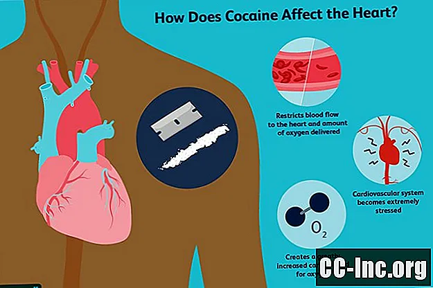 كيف يؤثر الكوكايين على نظام القلب والأوعية الدموية