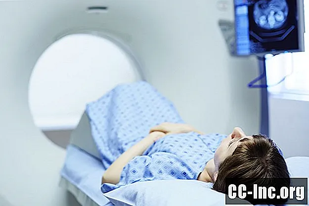 Mikä on CT-keuhkosyövän seulonta?
