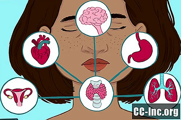Bagaimana Doktor Gagal Pesakit Penyakit Tiroid