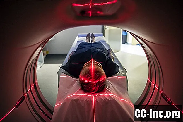 Comment les médecins trouvent la cause d'un accident vasculaire cérébral cryptogénique