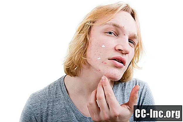 Como Duac trata a acne