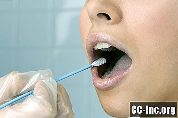 Как са свързани HPV и рак на устната кухина