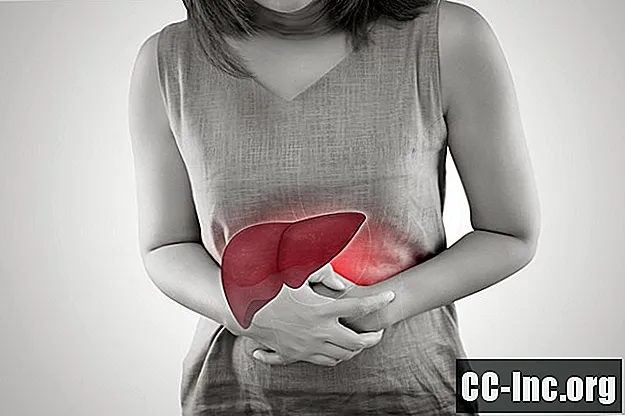 Kuo skiriasi hepatito C simptomai moterims