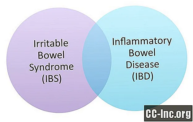 Μπορούν τα άτομα με IBD να έχουν επίσης IBS;