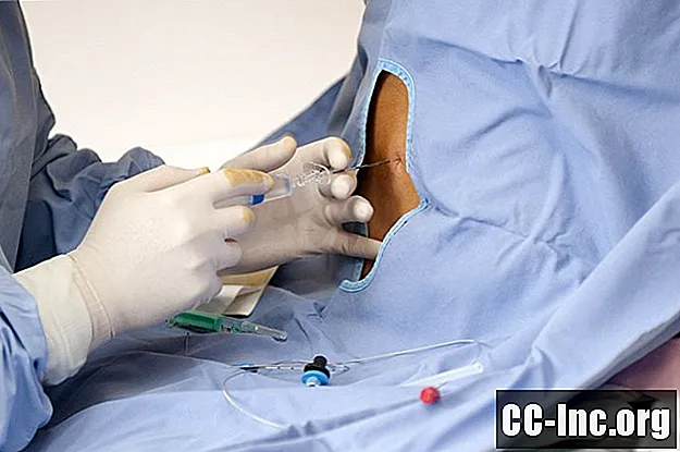 Как регионарная анестезия используется во время операции?