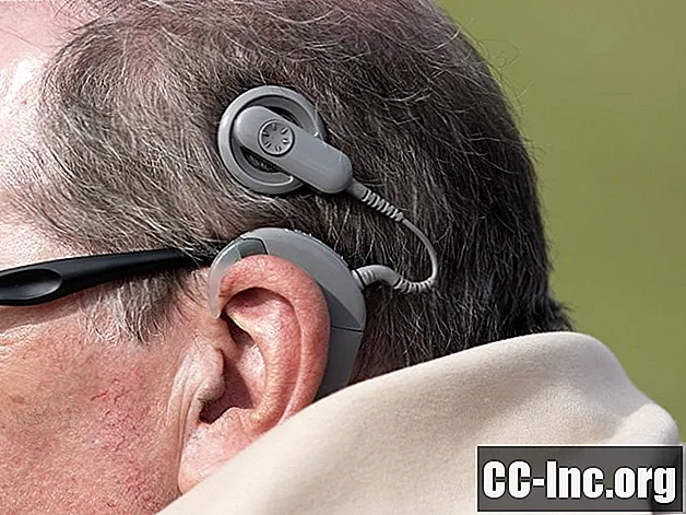 Wie wahrscheinlich ist ein Versagen des Cochlea-Implantats?
