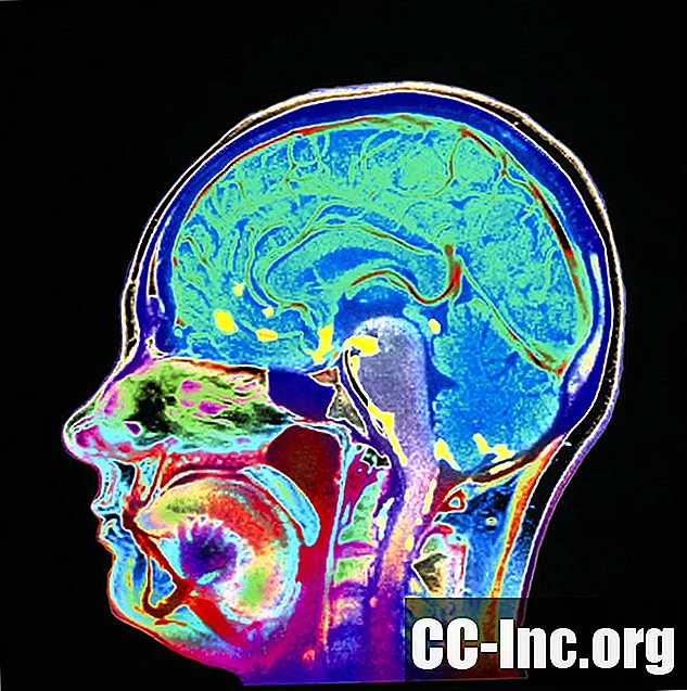 Hur hjärnhinneinflammation diagnostiseras - Medicin