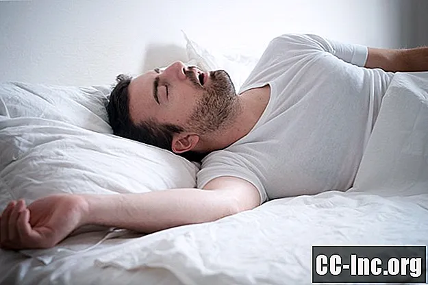 Hogyan kapcsolódik a férfiak fogorvosi állapota a horkoláshoz