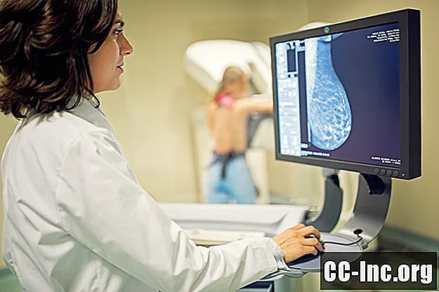 كيف يتم تشخيص سرطان الثدي المنتشر