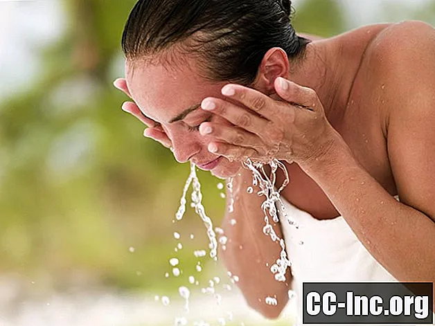 にきびがある場合、どのくらいの頻度で顔を洗うべきですか