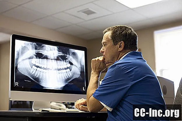 لماذا تستخدم الأشعة السينية للأسنان