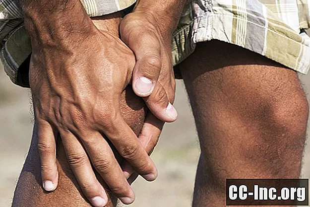 Kako referenčna bolečina otežuje diagnozo artritisa