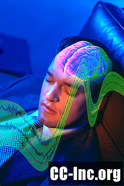 Kako izguba spanja aktivira celice smetarja v možganih
