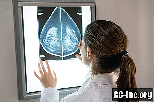 Jak diagnozuje się potrójnie ujemny rak piersi