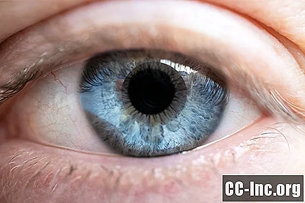 Kako deluje očesni test GDx za glavkom