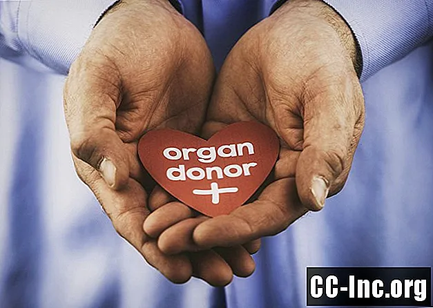 Kaip imuninė sistema veikia organų transplantaciją