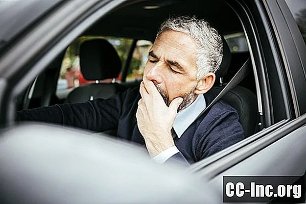 Cómo evitar quedarse dormido mientras conduce