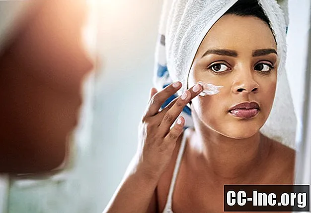 Cómo elegir un humectante para pieles propensas al acné
