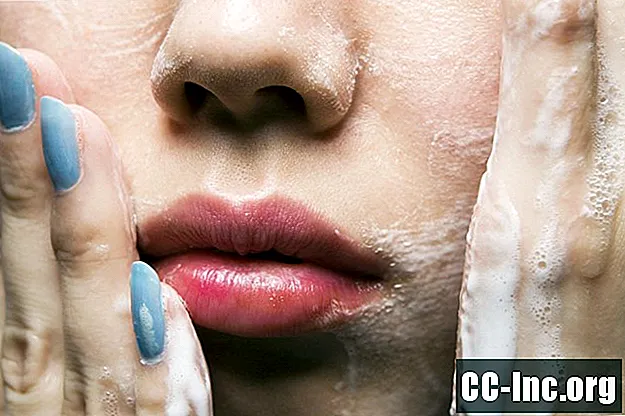 Como criar a melhor rotina de cuidados com a pele para acne