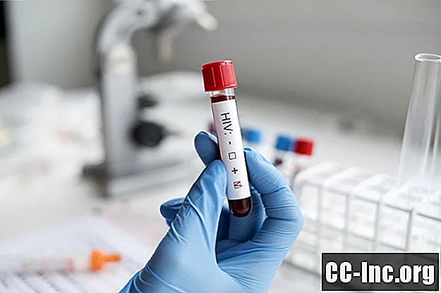 Kako dešifrirati rutinske testove krvi na HIV