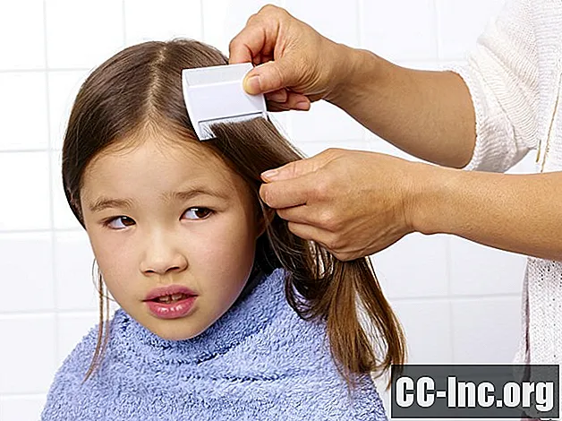 Hur man hittar huvudlöss i ditt barns hår