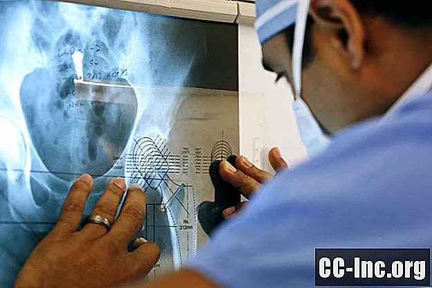 Doğru Ortopedi Cerrahı Nasıl Bulunur?