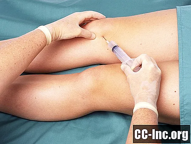 Kako izvršiti injekciju u koljeno