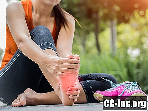 Comment prévenir les oignons et les douleurs aux pieds - Médicament