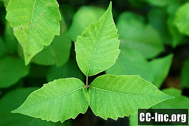 Hvordan forebygge og behandle Poison Ivy
