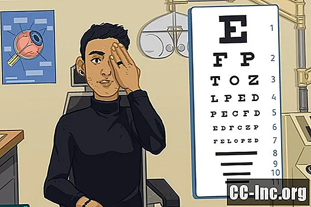 كيفية قراءة وصفة النظارات الطبية