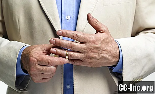 Hogyan távolítsuk el az ujjadon beragadt gyűrűt