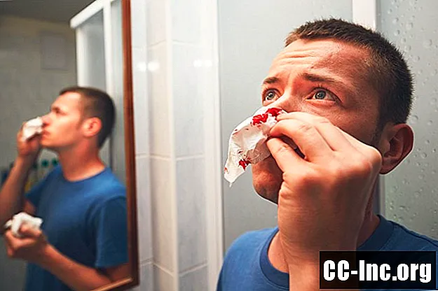 Как правильно остановить кровавый нос