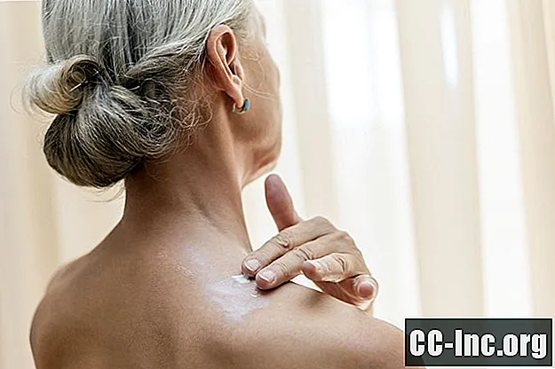 Kako liječiti akne na leđima i tijelu