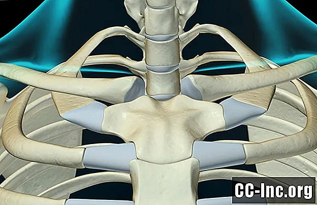 흉 쇄골 (SC) 관절의 부상을 치료하는 방법