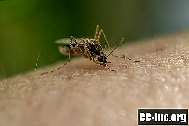 Cum se tratează mușcăturile de insecte și înțepăturile de păianjen