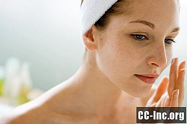Comment traiter l'acné légère