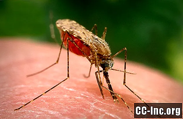 Wie man Mückenstiche behandelt und Infektionen erkennt