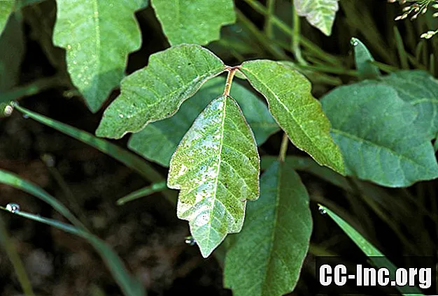 Cách điều trị Phát ban dị ứng do Poison Ivy và Poison Oak