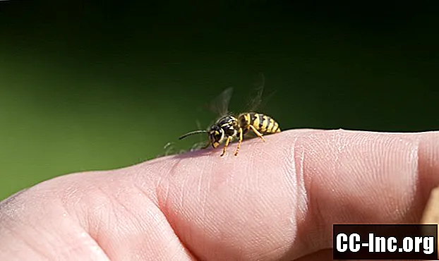 Wie man einen Bienenstich sicher behandelt