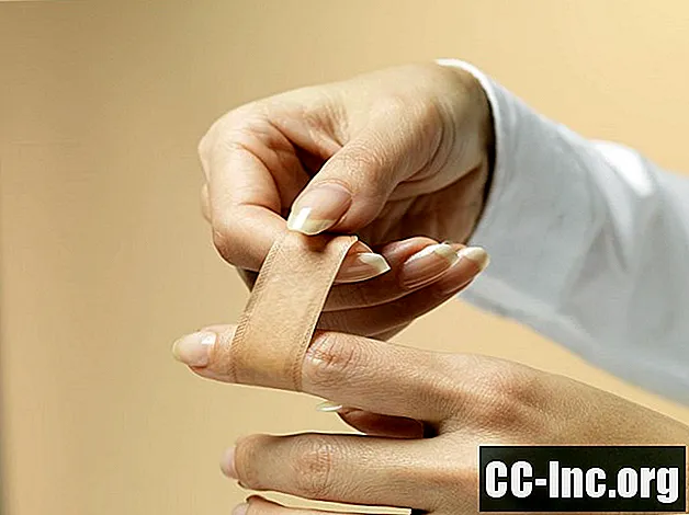 Cách xử lý vết cắt trên ngón tay của bạn