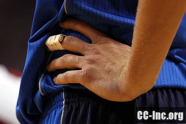 捻挫または脱臼した指を治療する方法