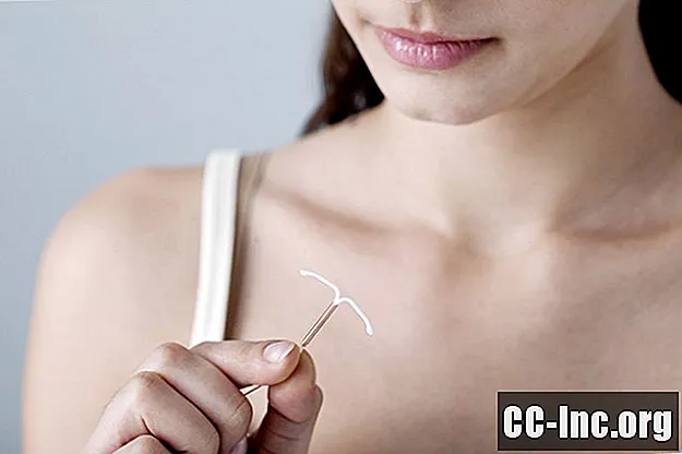 סקירה כללית של מכשיר המניעה IUD